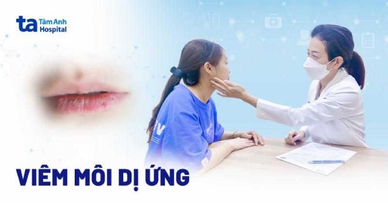 Giải mã hình ảnh nổi mẩn đỏ ngứa quanh miệng: Dấu hiệu cần khám nha khoa?